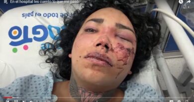 PAOLA SUÁREZ INFLUENCER DE ‘LAS PÉRDIDAS’ ES BRUTALMENTE GOLPEADA POR SU PROMETIDO